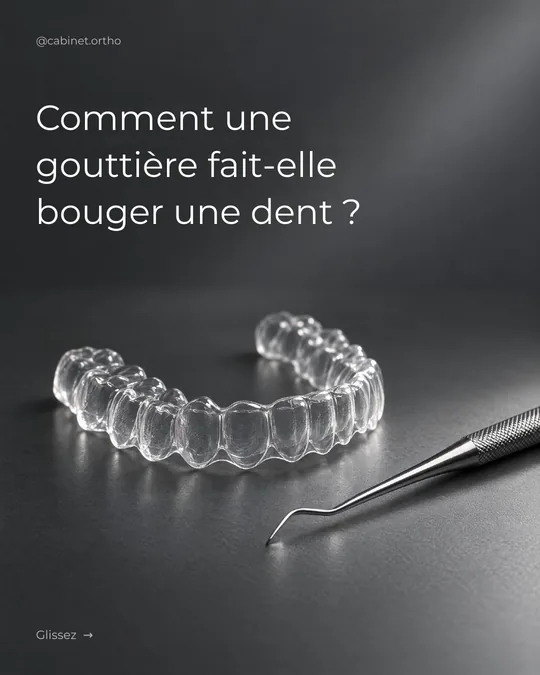 Première image : une gouttière transparente, « Comment une gouttière fait-elle bouger une dent ? »