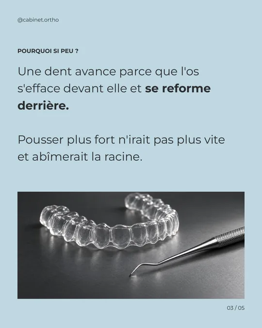 Troisième image : la dent avance parce que l’os s’efface devant elle et se reforme derrière